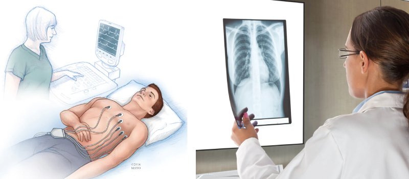 Portable X-ray test at home for bedridden patients in Hyderabad