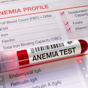 ANEMIA PROFILE BASIC (KOLMET)