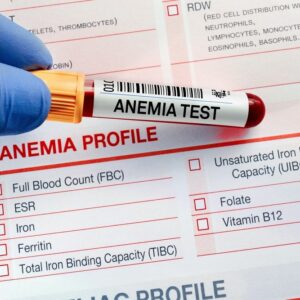 ANEMIA PROFILE