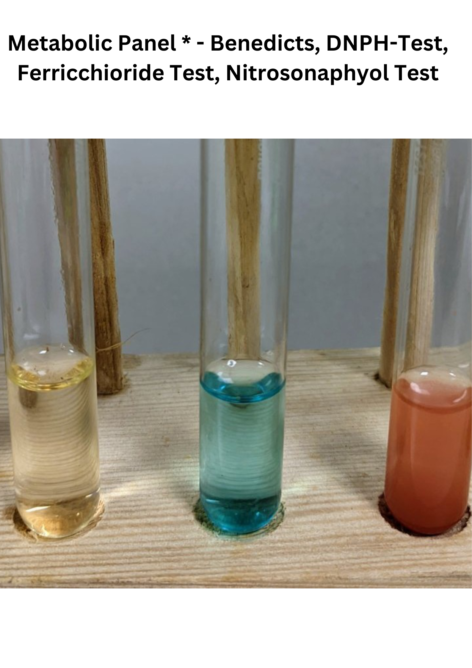 Metabolic Panel * - Benedicts, DNPH-Test, Ferricchioride Test, Nitrosonaphyol Test