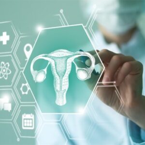 POLYCYSTIC OVARIAN DISORDER (PCOD) PROFILE EXTENDED : 17OHP,CHOLESTEROLTOTAL,DHEA-S, FSH,LH,PROLACTIN,TSH,SHBG,TESTOSTERONE TOTAL