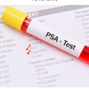 PSA Profile (PSA Total, PSA Free, Ratio for PSAT/PSA F)
