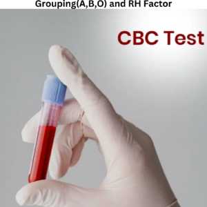 Pre-Employment Health Check: Complete Blood count (CBC), CUE – Complete Urine Analysis, Glucose – Random, Blood Grouping(A,B,O) and RH Factor