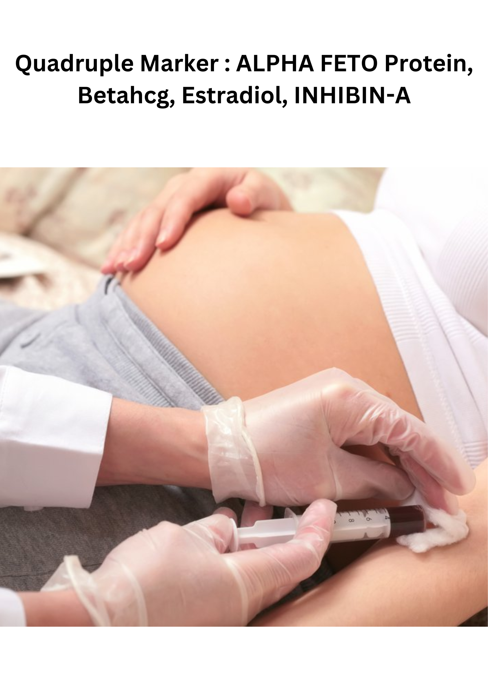 Quadruple Marker : ALPHA FETO Protein, Betahcg, Estradiol, INHIBIN-A