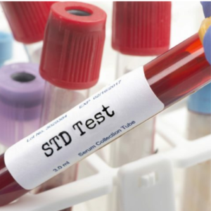 STD Detection Panel -HIV-Rapid, HBSAG -Rapid, HCV Rapid