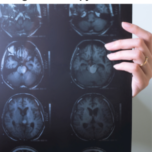 Somatic Gene Panel For Targeted Therapy (50 Genes)