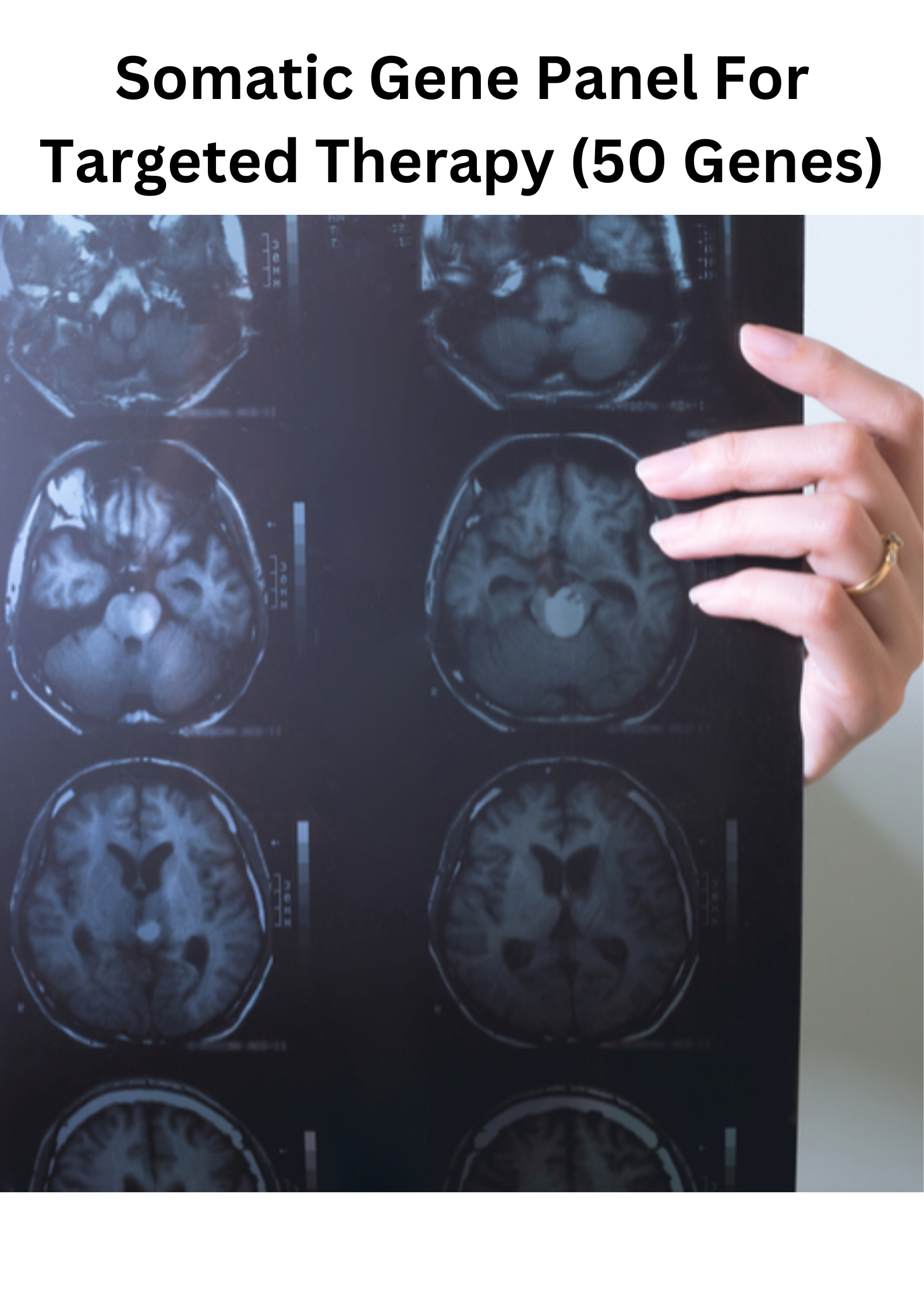 Somatic Gene Panel For Targeted Therapy (50 Genes)