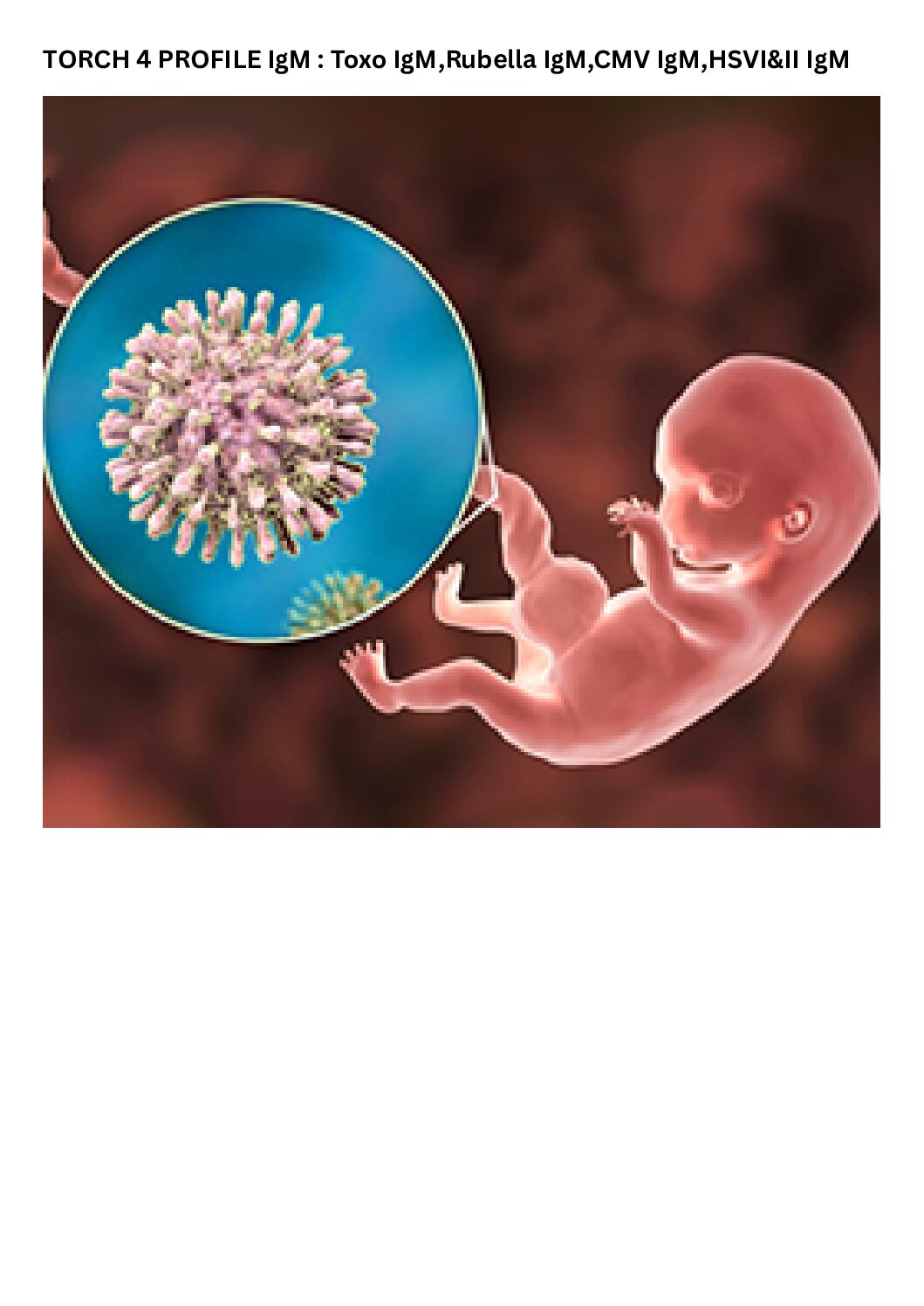 Torch 4 profile IgM : Toxo IgM,Rubella IgM,CMV IgM,HSVI&II IgM