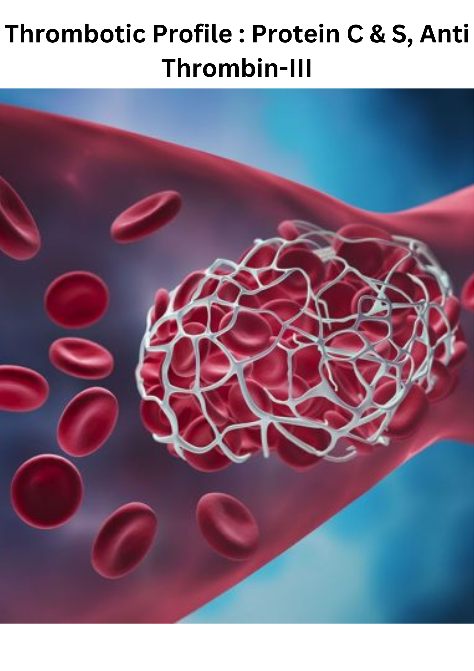 Thrombotic Profile : Protein C & S, Anti Thrombin-III