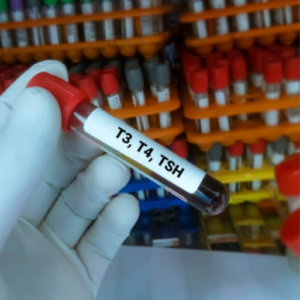 Thyroid Profile I : T3,T4,TSH