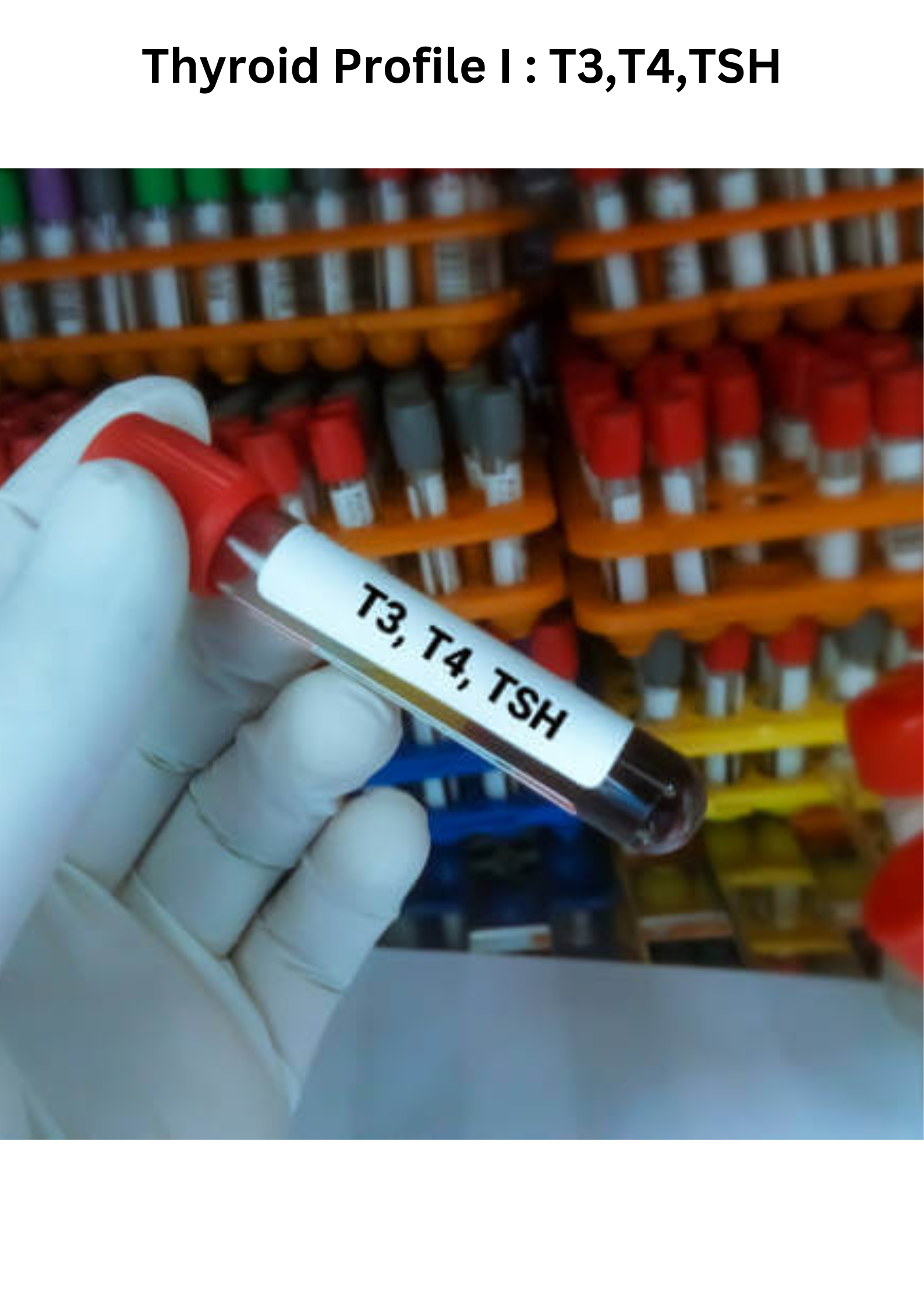 Thyroid Profile I : T3,T4,TSH