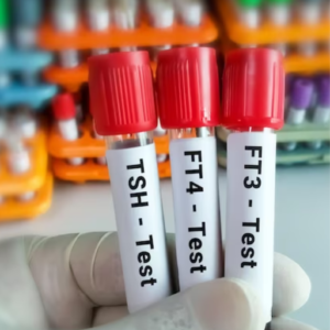 Thyroid Profile III : FT3,FT4,TSH