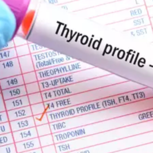 Thyroid Profile V : Ft3, Ft4, Ultra TSH
