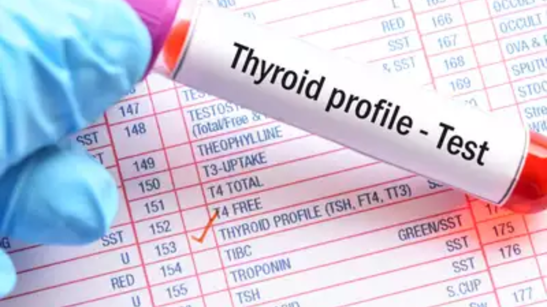 Thyroid Profile