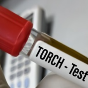 Torch 5 Profile IgM: Toxo IgM/,Rubella IgM,CMV IgM,HSV I IgM,HSV II IgM