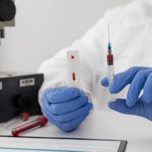Triple Marker With Graph : Alpha Feto Protein, BetahcG, Estriol