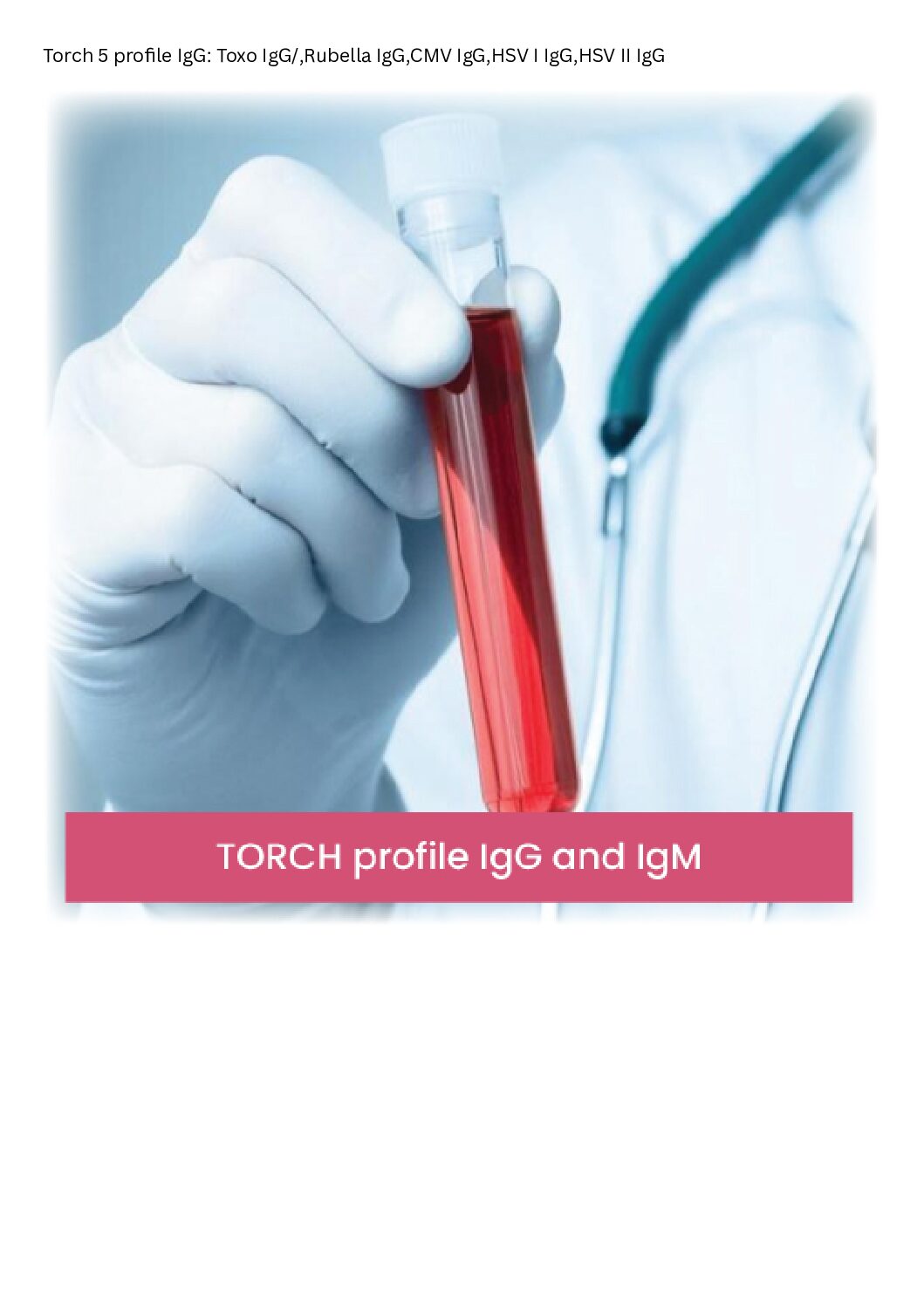 Torch 5 profile IgG: Toxo IgG/,Rubella IgG,CMV IgG,HSV I IgG,HSV II IgG