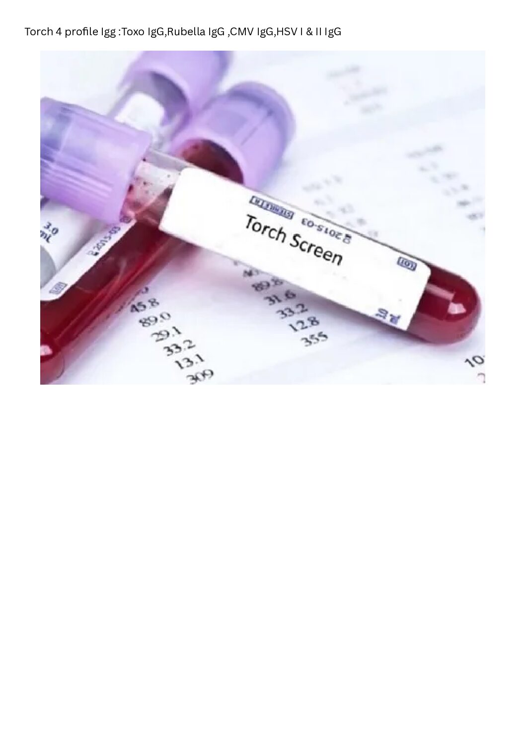 Torch 4 profile Igg :Toxo IgG,Rubella IgG ,CMV IgG,HSVI&II IgG