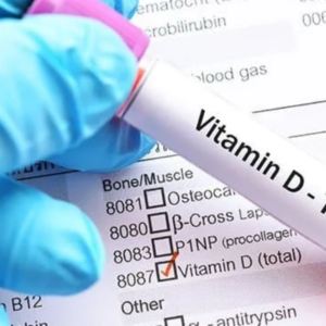 Vitamin Profile : Vitamin B12, 25(OH) Vitamin – D